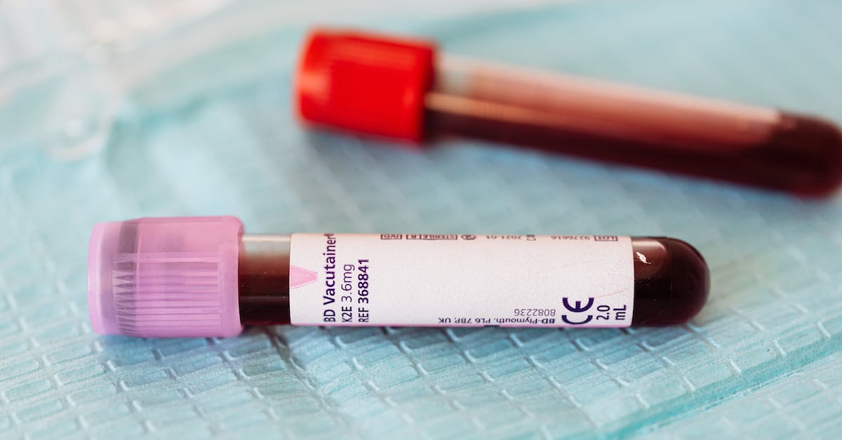 Czy wykonywanie badań krwi jest możliwe podczas menstruacji?